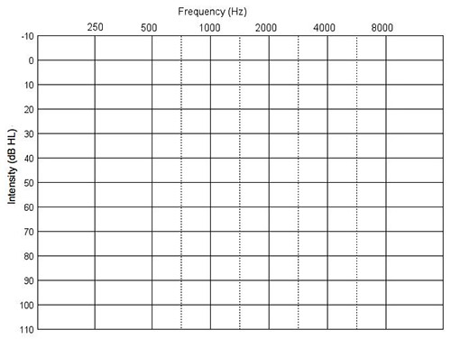 An Audiogram