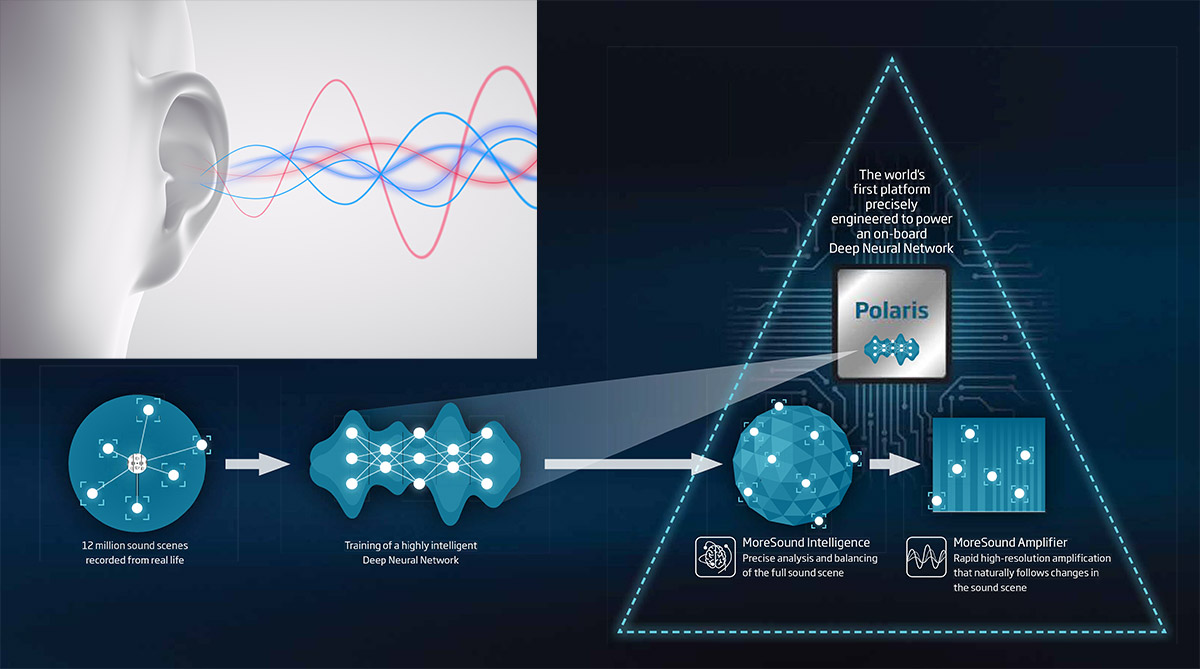 Oticon Deep Neural Network DNN
